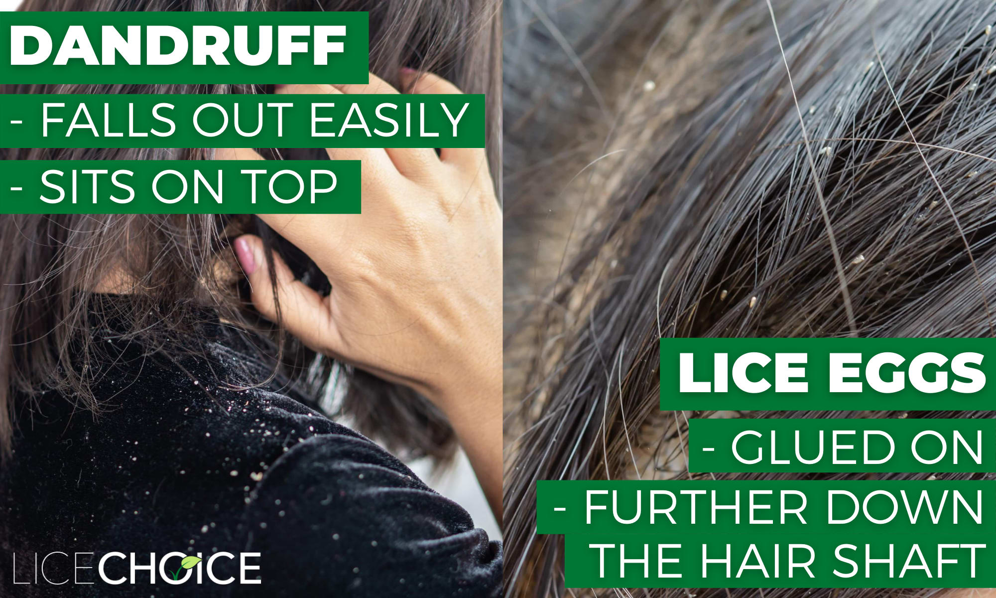 How To Check for Head Lice A Complete Guide to Lice